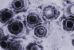 Il virus dell’herpes sconfigge i tumori